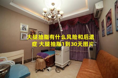 大腿抽脂有什么风险和后遗症 大腿抽脂1到30天图片